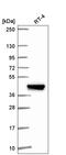 Interferon Induced Protein With Tetratricopeptide Repeats 5 antibody, HPA062180, Atlas Antibodies, Western Blot image 
