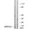 Mitochondrial Ribosomal Protein S21 antibody, A14514, Boster Biological Technology, Western Blot image 