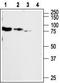 Purinergic Receptor P2X 2 antibody, TA328993, Origene, Western Blot image 