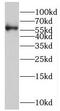 RORgt antibody, FNab07389, FineTest, Western Blot image 