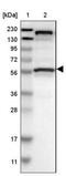 Tripartite Motif Containing 4 antibody, NBP1-80824, Novus Biologicals, Western Blot image 