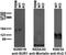 ATP Binding Cassette Subfamily C Member 8 antibody, 75-267, Antibodies Incorporated, Western Blot image 