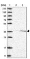 Cyclin Dependent Kinase 20 antibody, PA5-55593, Invitrogen Antibodies, Western Blot image 