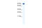 Zinc finger Y-chromosomal protein 1 antibody, 28-603, ProSci, Enzyme Linked Immunosorbent Assay image 