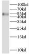 NAD Kinase antibody, FNab05536, FineTest, Western Blot image 