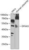 Gasdermin E antibody, A32407-1, Boster Biological Technology, Western Blot image 