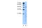 Solute carrier family 25 member 46 antibody, 29-949, ProSci, Western Blot image 