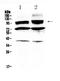 Hyperpolarization Activated Cyclic Nucleotide Gated Potassium And Sodium Channel 2 antibody, A02804, Boster Biological Technology, Western Blot image 