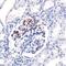 Complement Component 4B (Chido Blood Group), Copy 2 antibody, PA1-39488, Invitrogen Antibodies, Immunohistochemistry paraffin image 