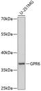 G Protein-Coupled Receptor 6 antibody, GTX66285, GeneTex, Western Blot image 