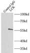 p56-LCK antibody, FNab04725, FineTest, Immunoprecipitation image 