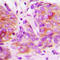 LYN Proto-Oncogene, Src Family Tyrosine Kinase antibody, LS-C368407, Lifespan Biosciences, Immunohistochemistry frozen image 