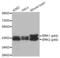 Mitogen-Activated Protein Kinase 1 antibody, LS-C330853, Lifespan Biosciences, Western Blot image 