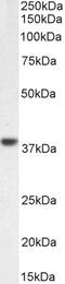 Adaptor Related Protein Complex 2 Subunit Alpha 1 antibody, 43-204, ProSci, Immunocytochemistry image 