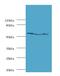 Ubiquitin Specific Peptidase 14 antibody, LS-C317694, Lifespan Biosciences, Western Blot image 