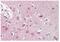 Origin Recognition Complex Subunit 3 antibody, GTX89992, GeneTex, Immunohistochemistry paraffin image 