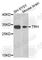 Thyrotropin Releasing Hormone antibody, A8322, ABclonal Technology, Western Blot image 