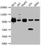 Signal Transducer And Activator Of Transcription 6 antibody, CSB-RA988543A0HU, Cusabio, Western Blot image 
