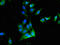 Protein C, Inactivator Of Coagulation Factors Va And VIIIa antibody, orb50950, Biorbyt, Immunocytochemistry image 