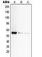 TNF Receptor Superfamily Member 1A antibody, MBS820194, MyBioSource, Western Blot image 