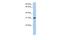 Dickkopf Like Acrosomal Protein 1 antibody, A12366, Boster Biological Technology, Western Blot image 