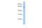 Arylsulfatase E antibody, 25-711, ProSci, Western Blot image 