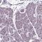 Ubiquitin Like Modifier Activating Enzyme 3 antibody, HPA065335, Atlas Antibodies, Immunohistochemistry frozen image 