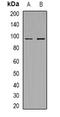 MER Proto-Oncogene, Tyrosine Kinase antibody, orb382574, Biorbyt, Western Blot image 