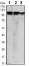 Hexokinase 2 antibody, ab104836, Abcam, Western Blot image 