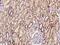 Branched Chain Keto Acid Dehydrogenase E1 Subunit Alpha antibody, GTX02232, GeneTex, Immunohistochemistry paraffin image 