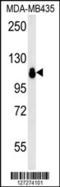 Glucosidase II Alpha Subunit antibody, LS-B14411, Lifespan Biosciences, Western Blot image 