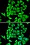 NIMA Related Kinase 3 antibody, LS-C334861, Lifespan Biosciences, Immunofluorescence image 