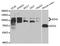 Enhancer Of Zeste 2 Polycomb Repressive Complex 2 Subunit antibody, A11085, ABclonal Technology, Western Blot image 