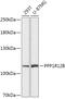 Protein Phosphatase 1 Regulatory Subunit 12B antibody, 16-965, ProSci, Western Blot image 