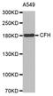 Complement Factor H antibody, STJ111081, St John
