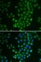 cAMP-dependent protein kinase catalytic subunit beta antibody, orb167238, Biorbyt, Immunocytochemistry image 