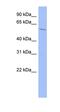 Insulin Like Growth Factor 2 MRNA Binding Protein 2 antibody, orb330141, Biorbyt, Western Blot image 