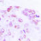 Activating Transcription Factor 2 antibody, LS-C353955, Lifespan Biosciences, Immunohistochemistry paraffin image 