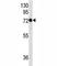 Syndecan 1 antibody, F40400-0.4ML, NSJ Bioreagents, Western Blot image 