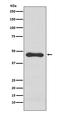 Serpin Family E Member 1 antibody, M00637, Boster Biological Technology, Western Blot image 