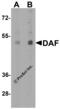 CD55 Molecule (Cromer Blood Group) antibody, 7937, ProSci, Western Blot image 