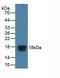 Eukaryotic Translation Initiation Factor 4E Binding Protein 1 antibody, LS-C298084, Lifespan Biosciences, Western Blot image 