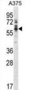 Protein Tyrosine Kinase 6 antibody, abx028419, Abbexa, Western Blot image 