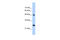 Chromogranin A antibody, 29-670, ProSci, Enzyme Linked Immunosorbent Assay image 