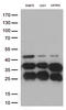 Cathepsin L antibody, LS-C793142, Lifespan Biosciences, Western Blot image 