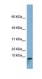 T Cell Leukemia Translocation Altered antibody, orb325501, Biorbyt, Western Blot image 