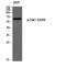 Mitogen-Activated Protein Kinase Kinase Kinase 7 antibody, A01458S439, Boster Biological Technology, Western Blot image 