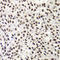 Negative Elongation Factor Complex Member E antibody, LS-C346175, Lifespan Biosciences, Immunohistochemistry paraffin image 