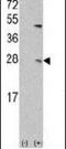 Ubiquitin-conjugating enzyme E2 C antibody, PA5-11971, Invitrogen Antibodies, Western Blot image 