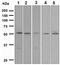 Activin A Receptor Type 1B antibody, ab109300, Abcam, Western Blot image 